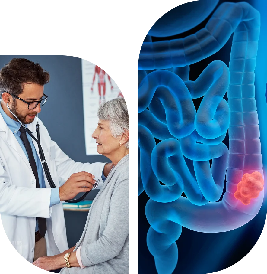 A doctor examines an older woman; next to them is a digital illustration of a colon with a highlighted tumor.